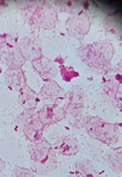 Haemophilus influenzaeのアイキャッチ画像